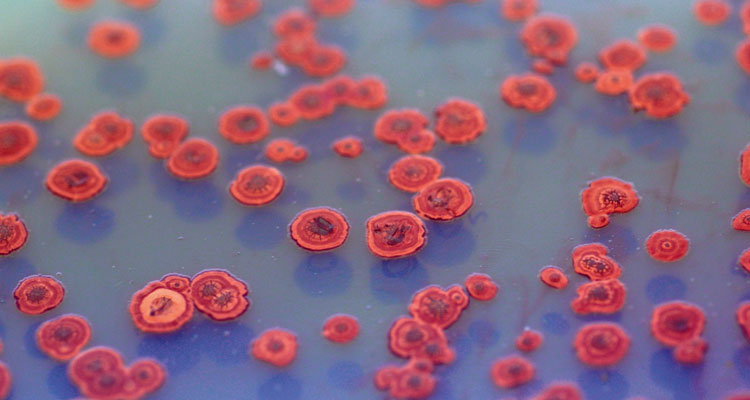 Kolonien des Bakteriums »Xenorhabdus szentirmaii«. Deutlich zu erkennen ist die durch verschiedene Naturstoffe hervorgerufene rote Pigmentierung der Kolonien