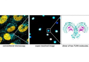 TLR4-Rezeptoren auf der Zelloberfläche von Hirntumorzellen sind im Lichtmikroskop (links) als cyan gefärbte Punkte zu sehen. Mit hochaufgelöster Mikroskopie (Mitte) sieht man schon einzelne TLR4-Cluster. Die neue superauflösende Mikroskoptechnik erlaubt es, zwischen Monomeren und Dimeren zu unterscheiden. Das rechte Bild zeigt die Kristallstruktur eines Dimers. © Widera/Heilemann