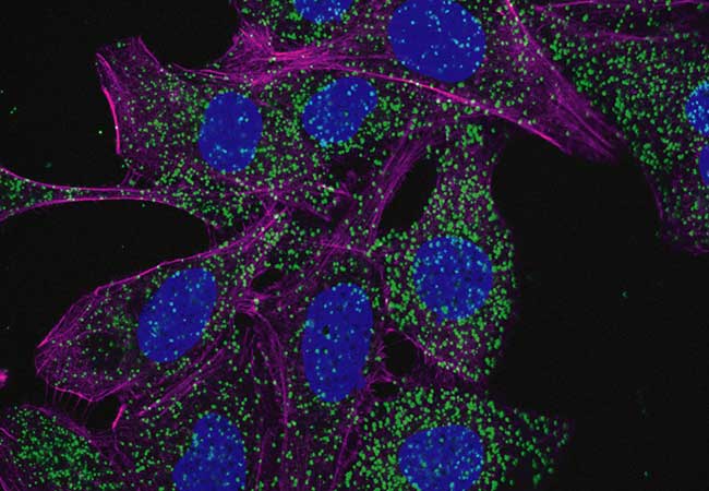 Study / Leukemia cells activate cellular recycling program | Aktuelles aus der Goethe-Universität Frankfurt