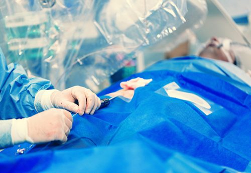 Herzkatheter werden minimalinvasiv in der Regel durch eine Arm-Arterie eingeführt. Am Universitätsklinikum Frankfurt wird die Herzbehandlung durch hochauflösende Bildgebung begleitet. Foto: MAD.vertise/Shutterstock