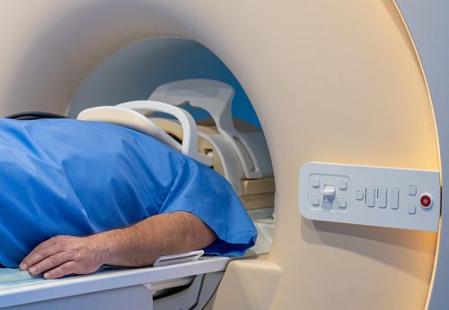 Kernspinaufnahmen verraten mit neuen Technologien mehr über Charakteristika und Ausdehnung von Tumoren. Foto: simonkr/istock