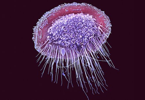 Die Riesenfresszellen des Immunsystems – Makrophagen – werden in der Umgebung von Tumoren zu Überläufern und unterstützen das Krebswachstum. Foto: Science Photo Library