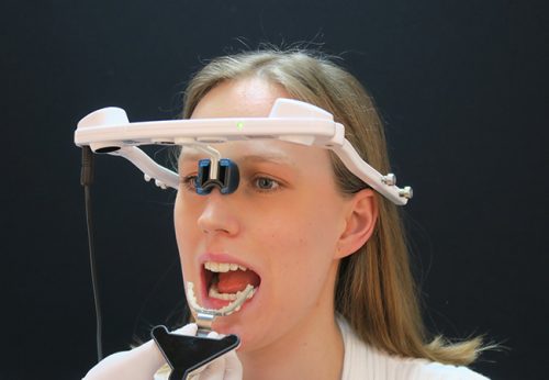 Moderne Verfahren zur Bewegungsanalyse des Kiefers (hier Jaw Motion Analyzer) ermöglichen eine erweiterte Diagnostik, ergänzen die Therapieoptionen und unterstützen beim Krankheitsverständnis. Foto: Poliklinik für zahnärztliche Prothetik